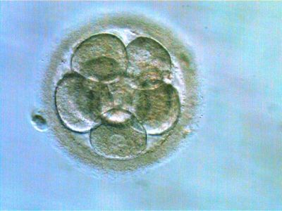 Embryo im 8Zellstadium Tag 3.jpg